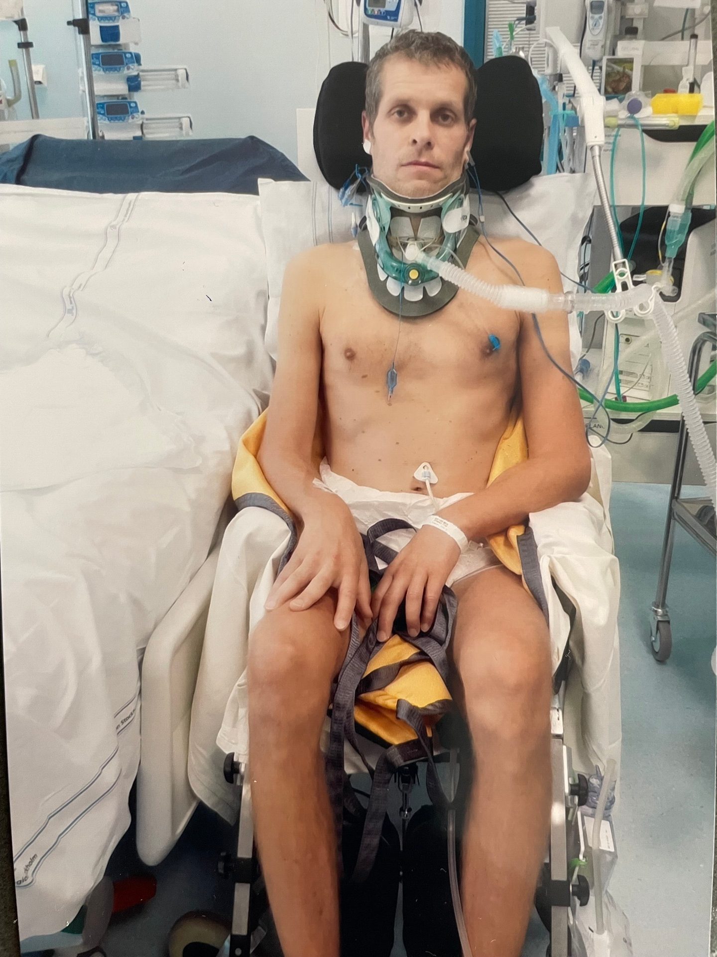 Patient with a neck brace and tubes, sitting in a hospital bed, looking at the camera.