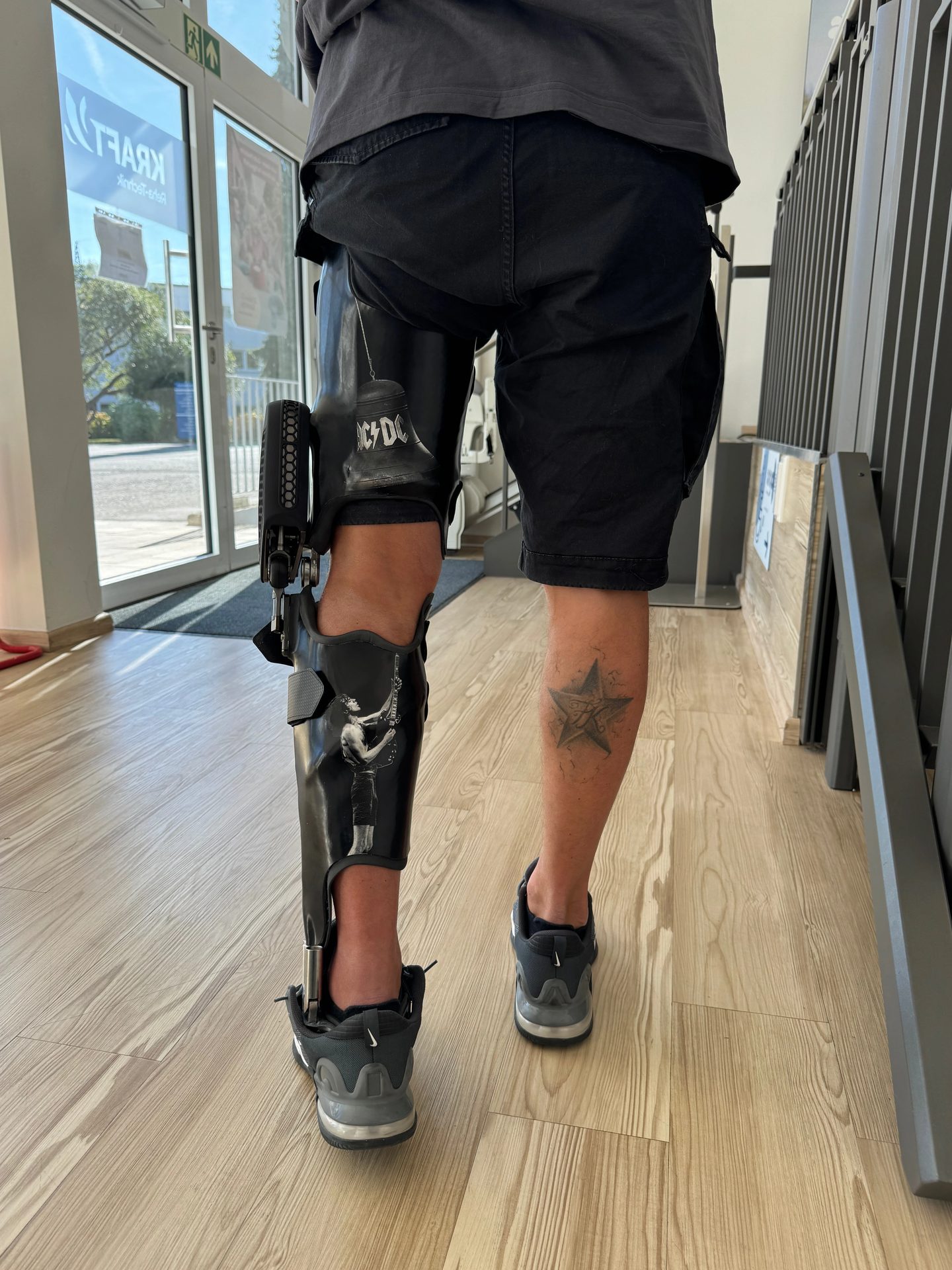 Person from behind, showing a custom AC/DC prosthetic leg with a guitar graphic and a star tattoo.