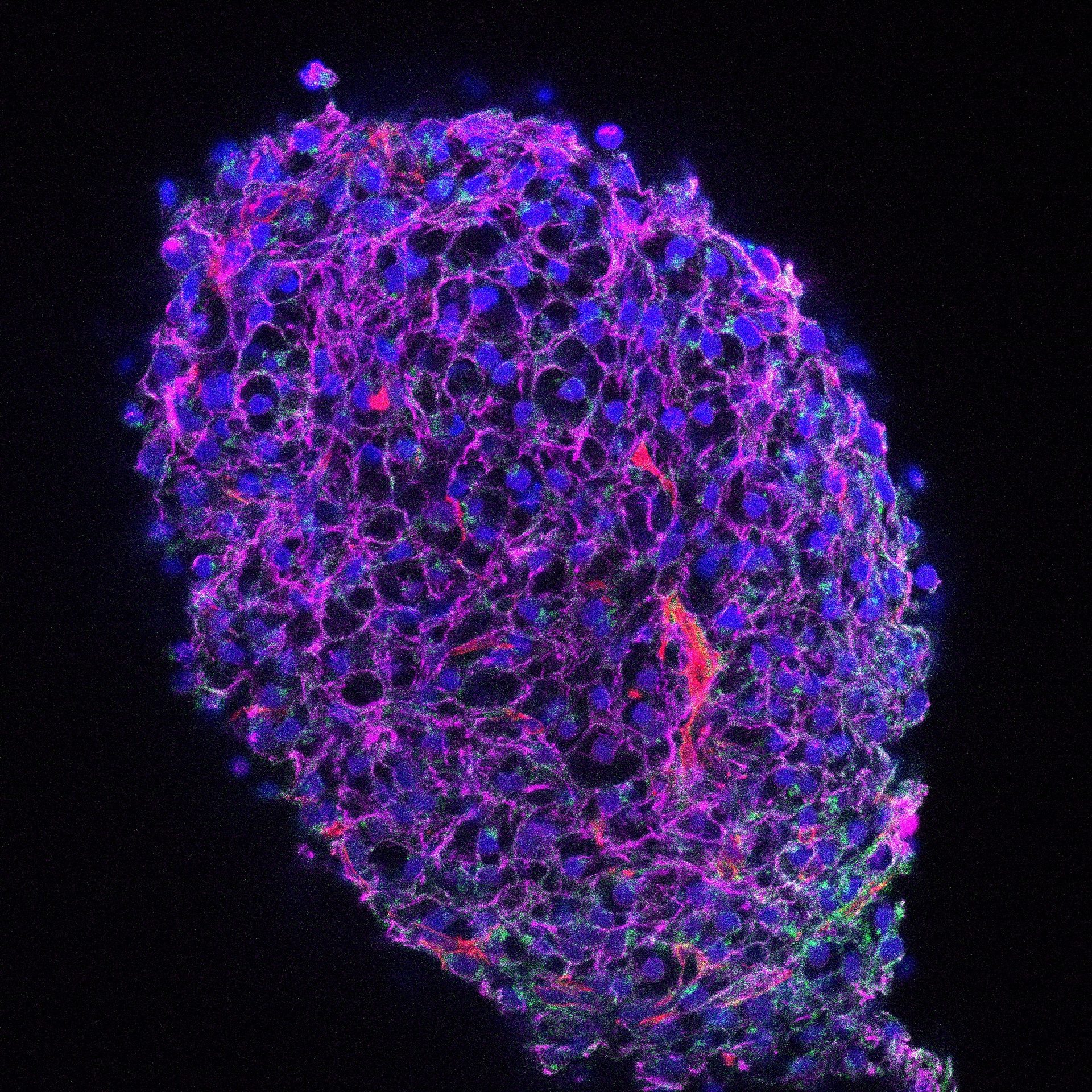 Fluorescent image of a dense cell spheroid with blue nuclei, magenta cell boundaries, and internal red/green structures.