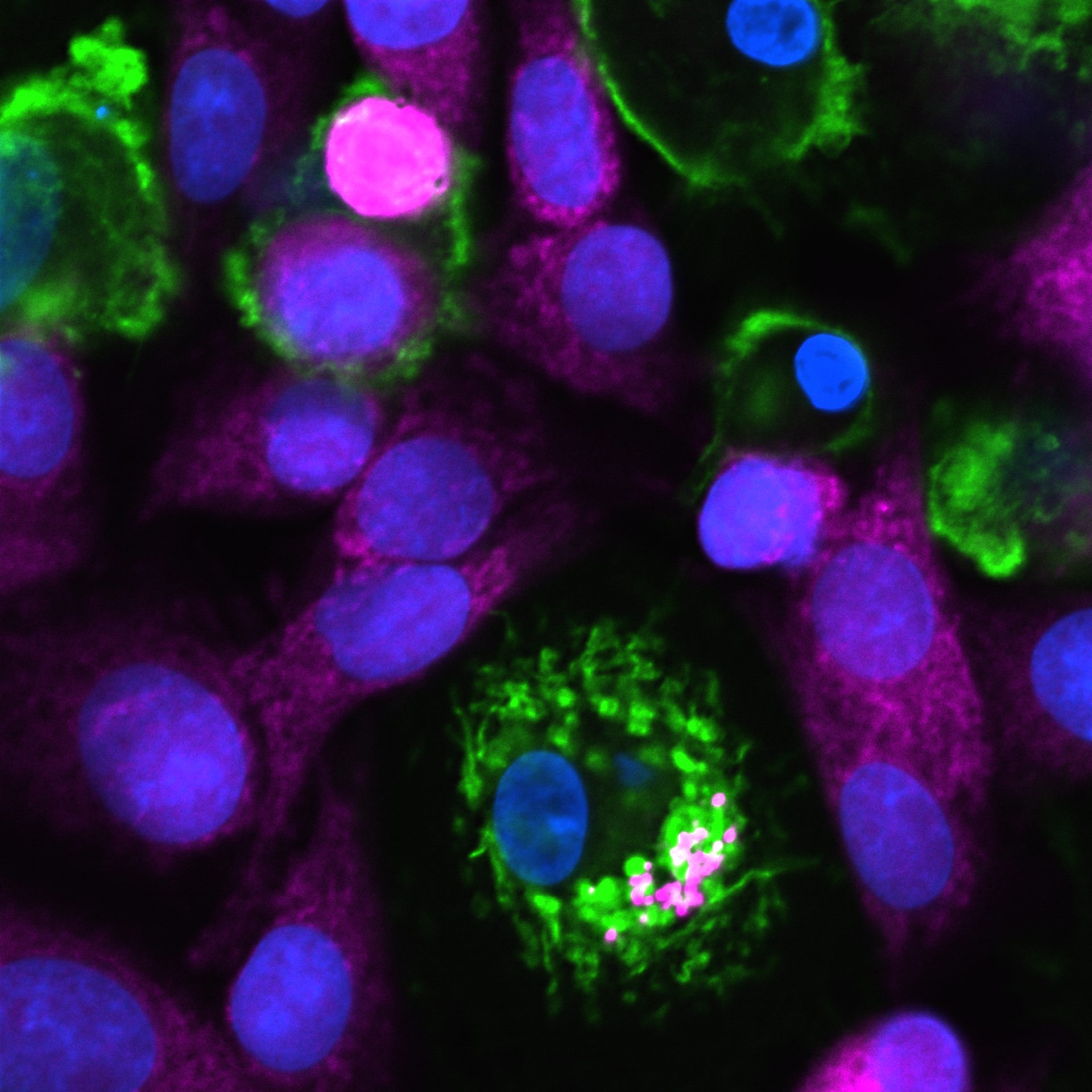 Fluorescent cells: blue nuclei, green cytoplasm, magenta structures.