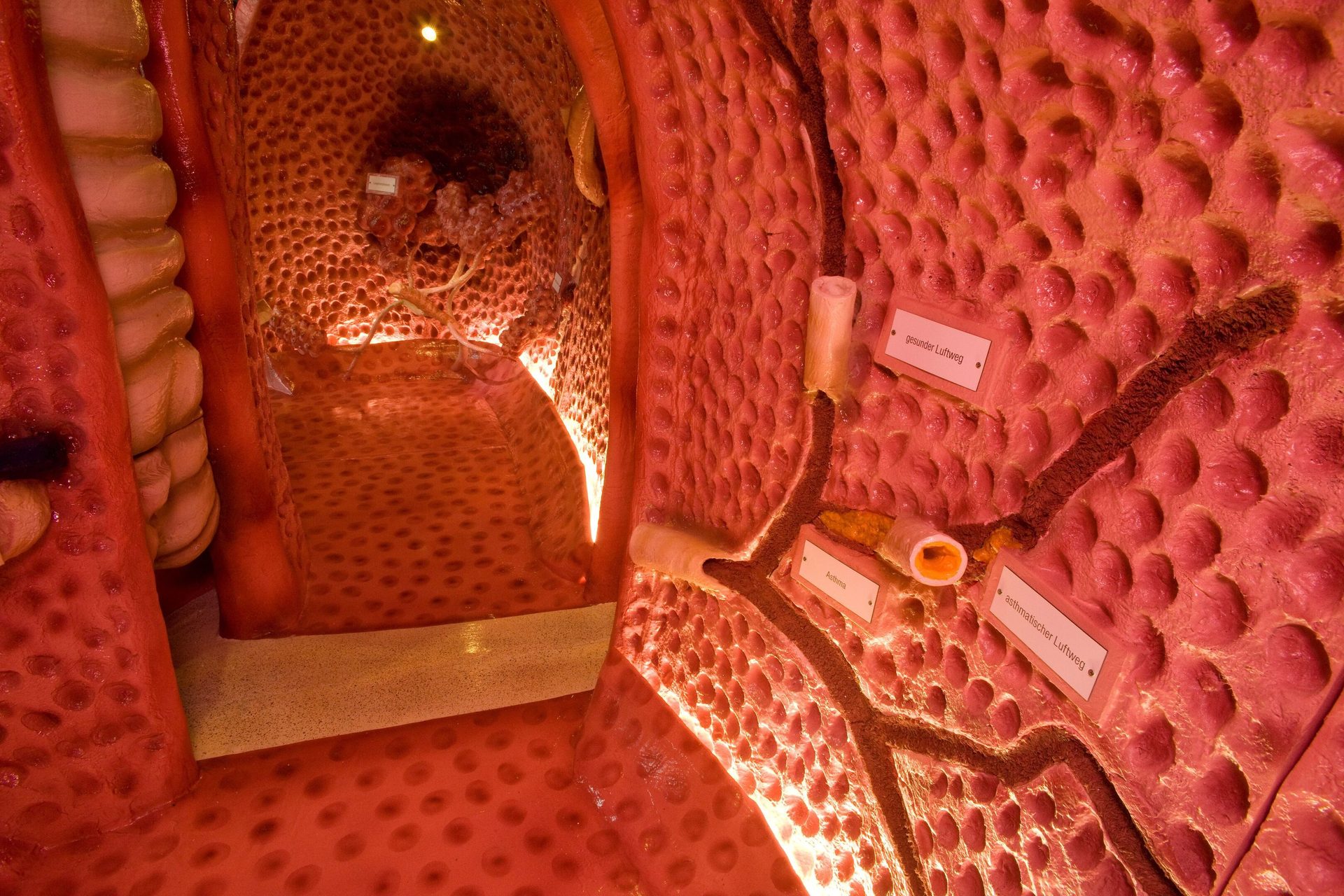 Giant walk-through anatomical model of healthy and asthmatic human airways with textured walls and German labels.