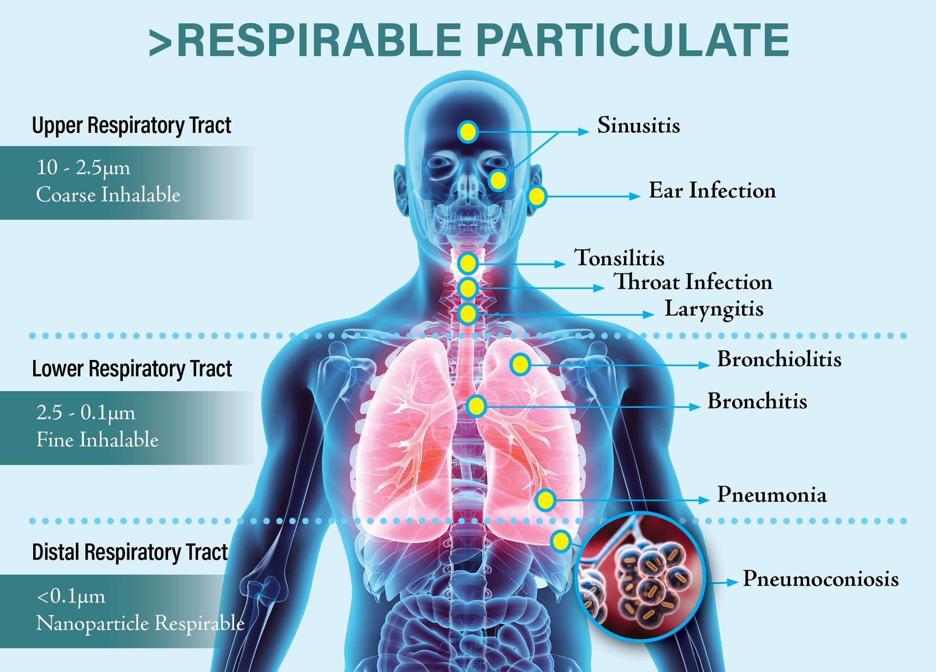 Illustration showing different parts of the body and what particles of dust can cause
