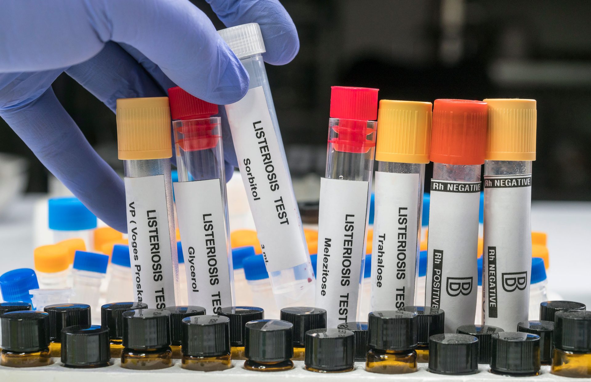 Gloved hand holding lab test tubes for listeriosis and blood type tests.