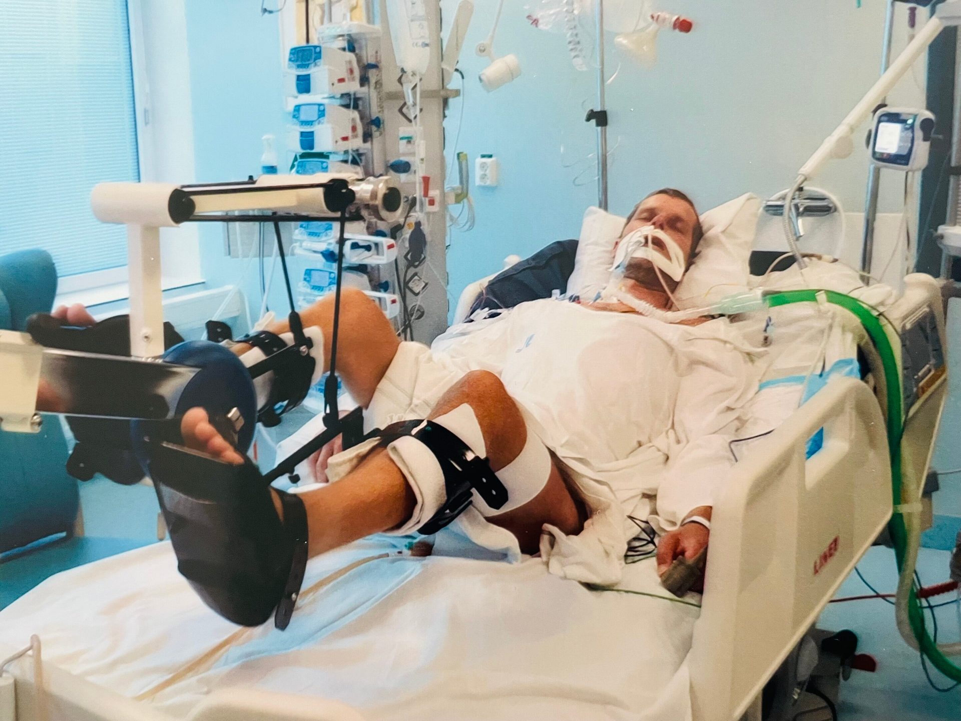 A man in a hospital bed with medical tubes and leg braces, suggesting intensive care.