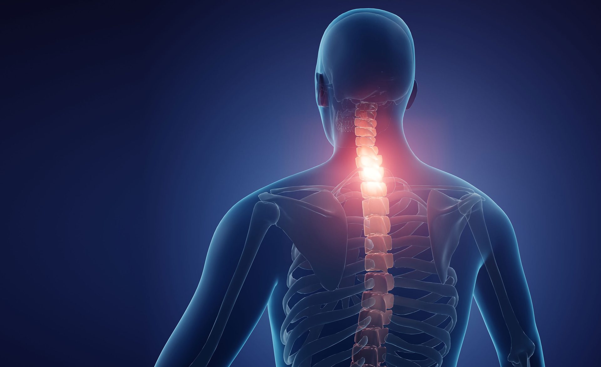Medical 3D render of human back, highlighting a painful, glowing red upper spine.