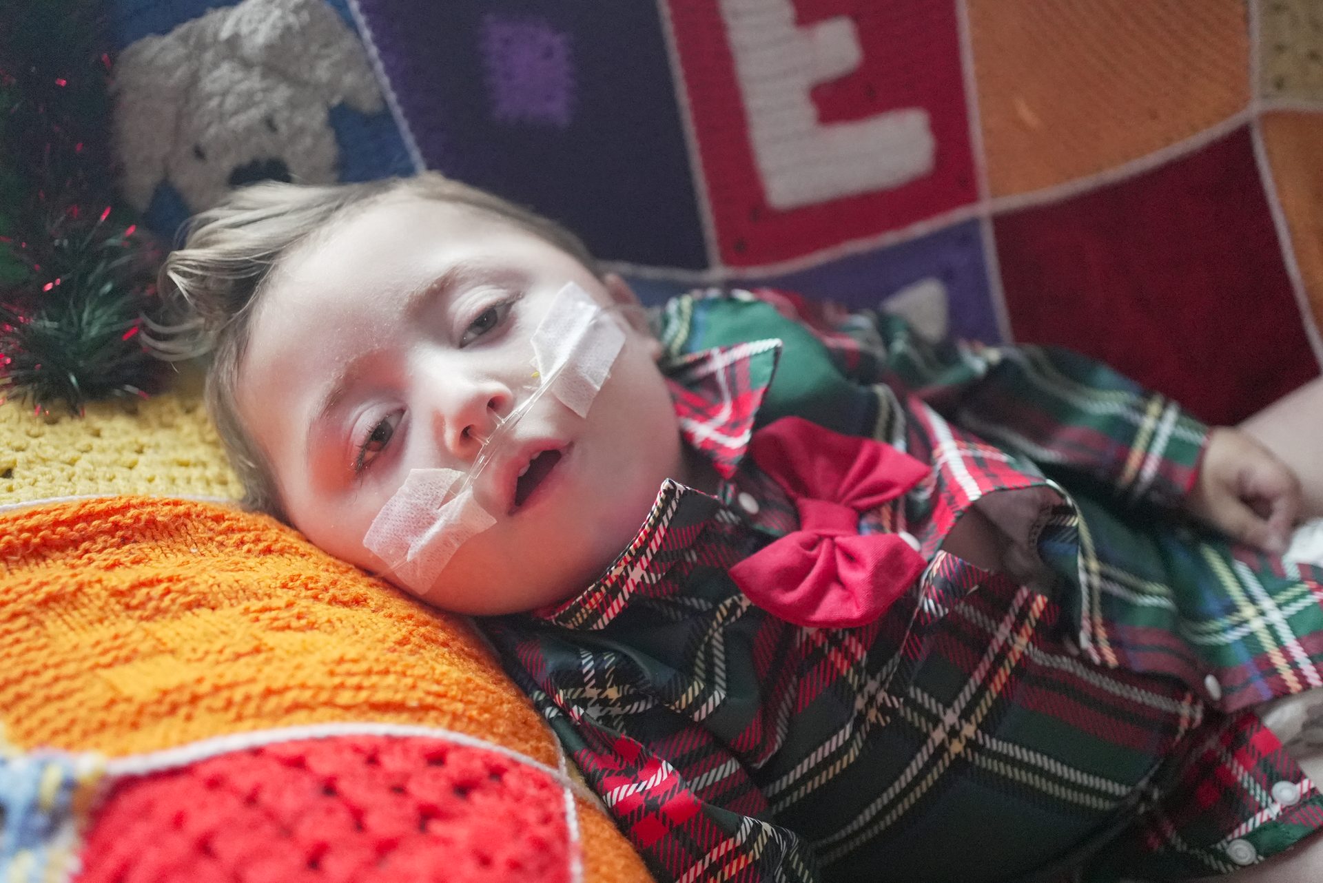 A child with a medical tube on their face, wearing a plaid outfit, lies on a colorful blanket.
