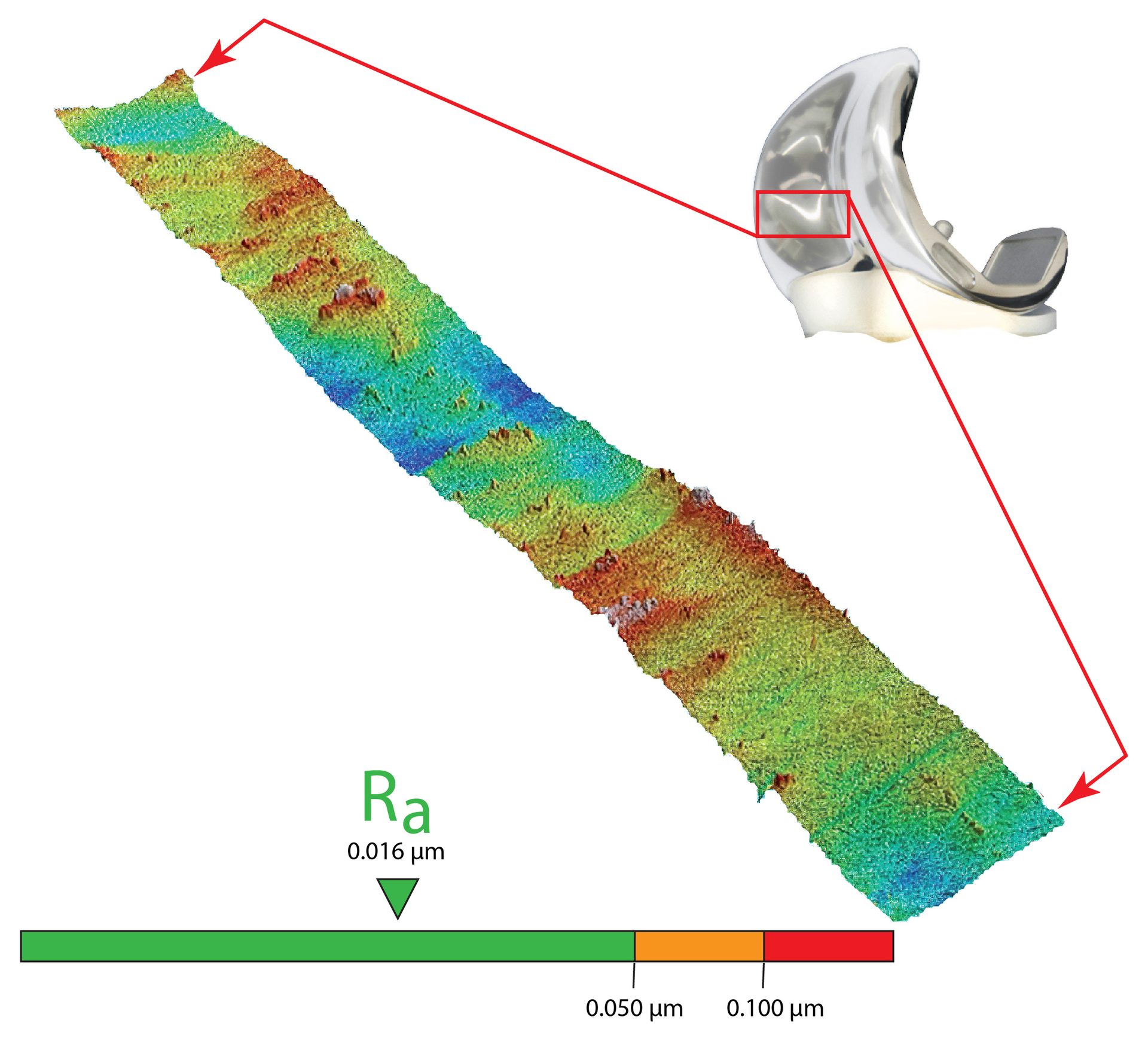 3D surface map of a knee implant's articulating surface showing Ra = 0.016 µm with a color scale.