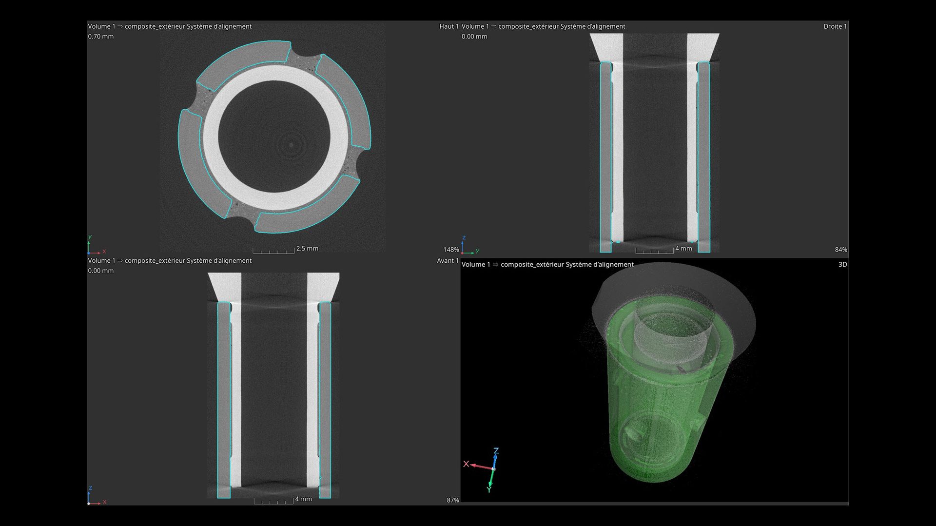 CT scans of connector rods 