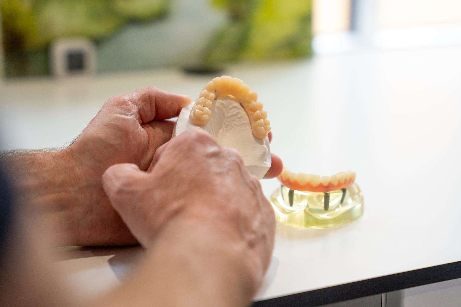 Hands of a dental technician holding a denture model, with an implant model on the table.