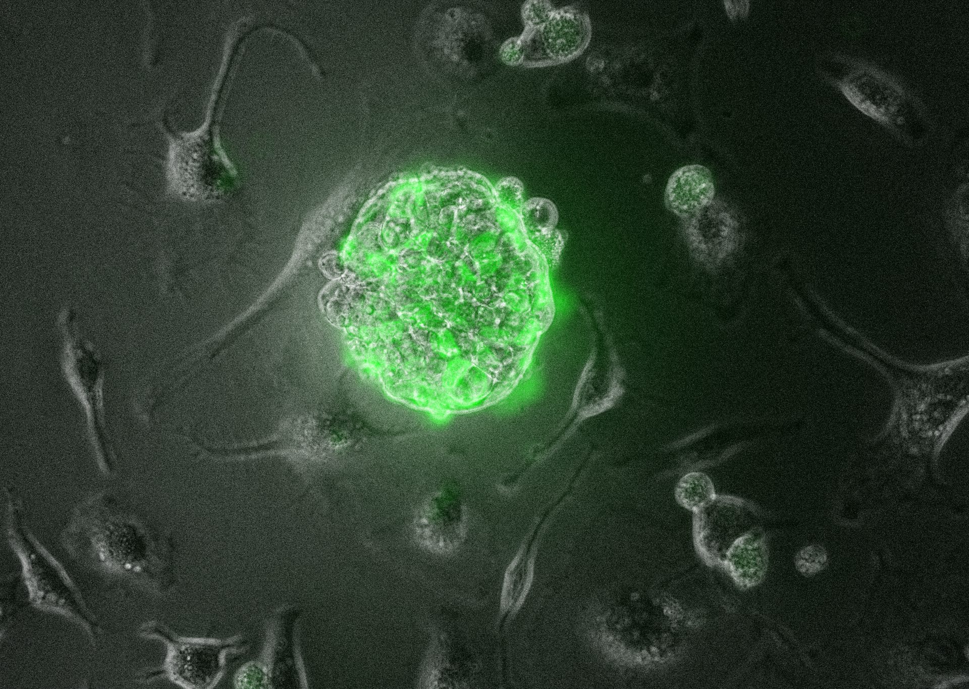Fluorescent green cell spheroid (organoid) surrounded by individual cells under a microscope.