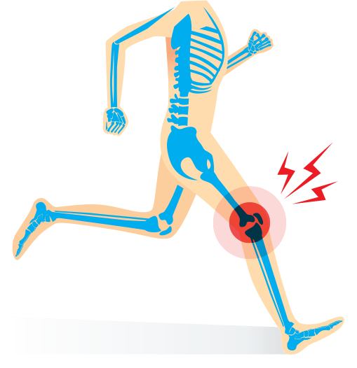 Human body, Playing sports, Arm, Leg, Knee, Elbow