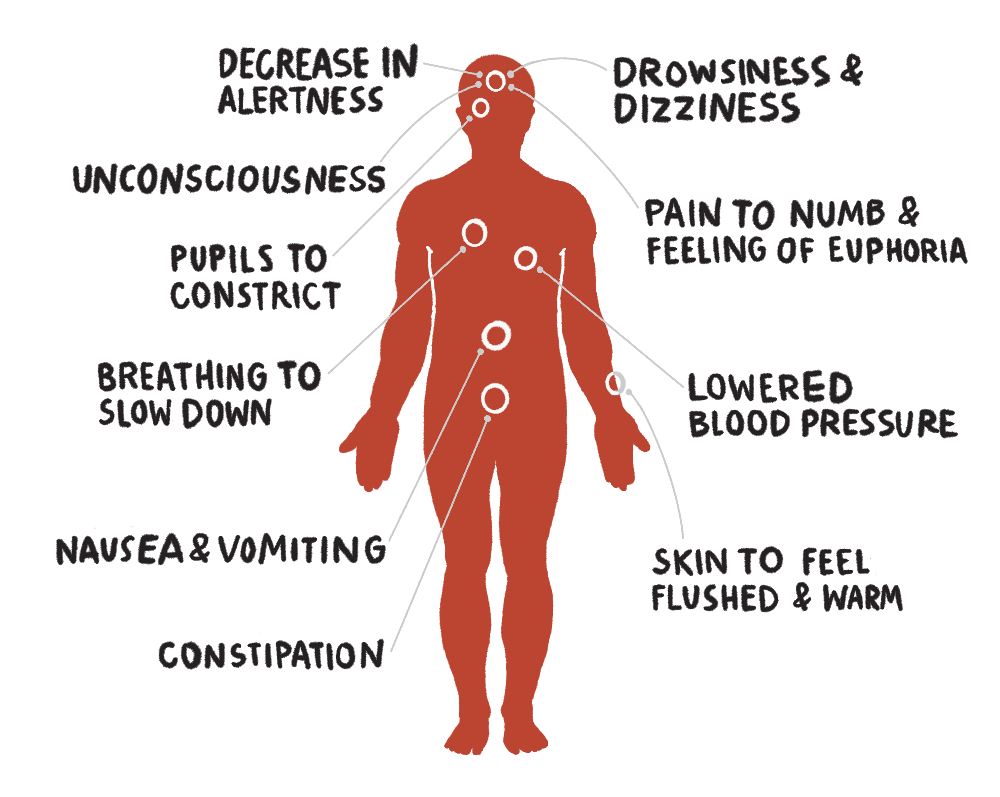 Diagram showing  how opioids impact the human body with call outs: decrease in alertness, unconsciousness, pupils to constrict, breathing to slow down, nausea and vomiting, constipation, drowsiness and dizziness, pain to dumb and feeling of euphoria, lowered blood pressure, and skin to feel flushed and warm