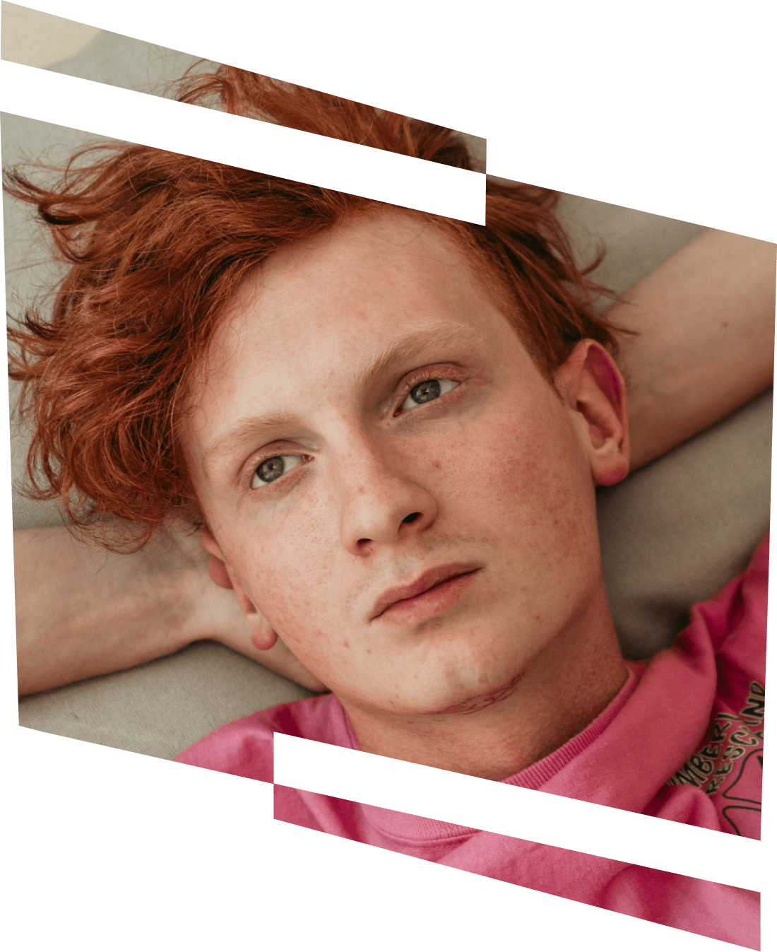 Red hair