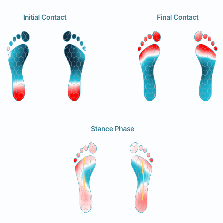 Foot pressure distribution during walking phases: initial contact, final contact, and stance.