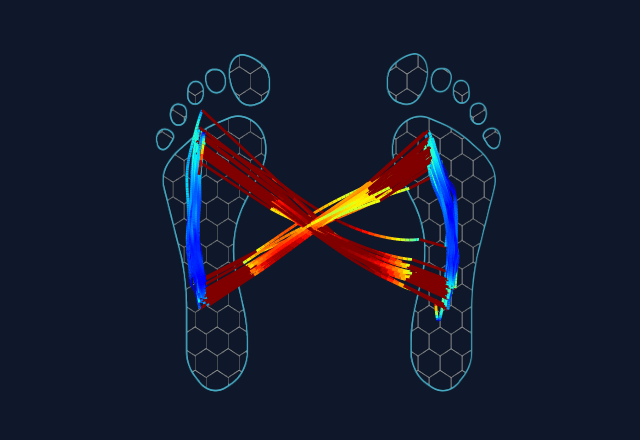 Diagram of two feet outlines with colored lines forming an X shape.