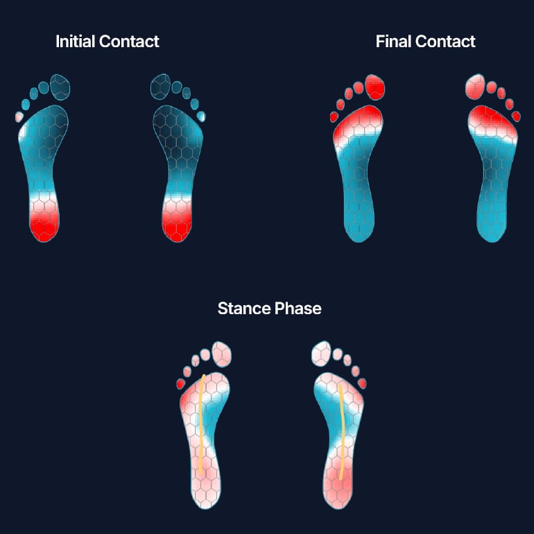 Foot pressure distribution during initial contact, final contact, and stance phase of gait.