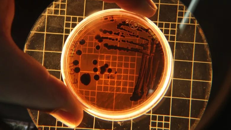 Petri dish with dark bacterial colonies on an orange agar medium over a grid, held by fingers.