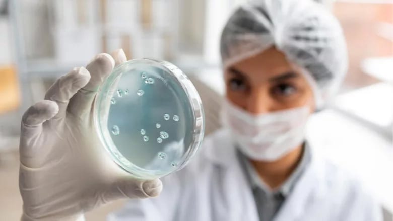Scientist in lab holding petri dish with microbial cultures.