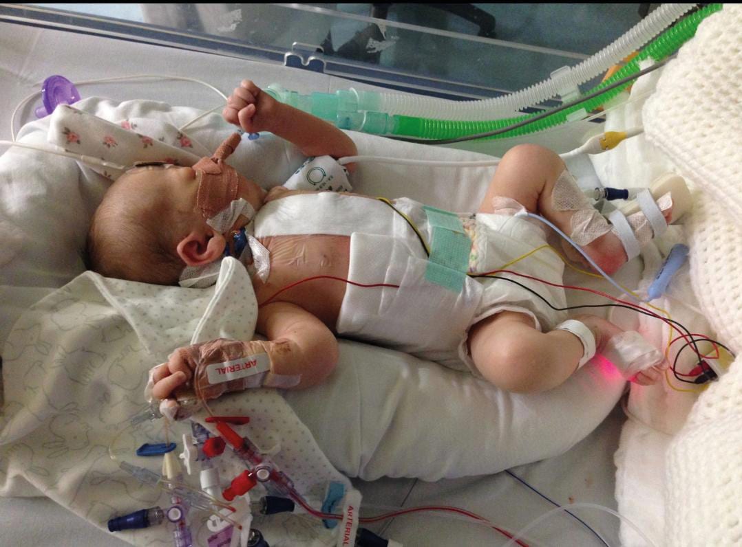 A baby lies in an incubator, connected to various medical tubes and wires, wearing a diaper.