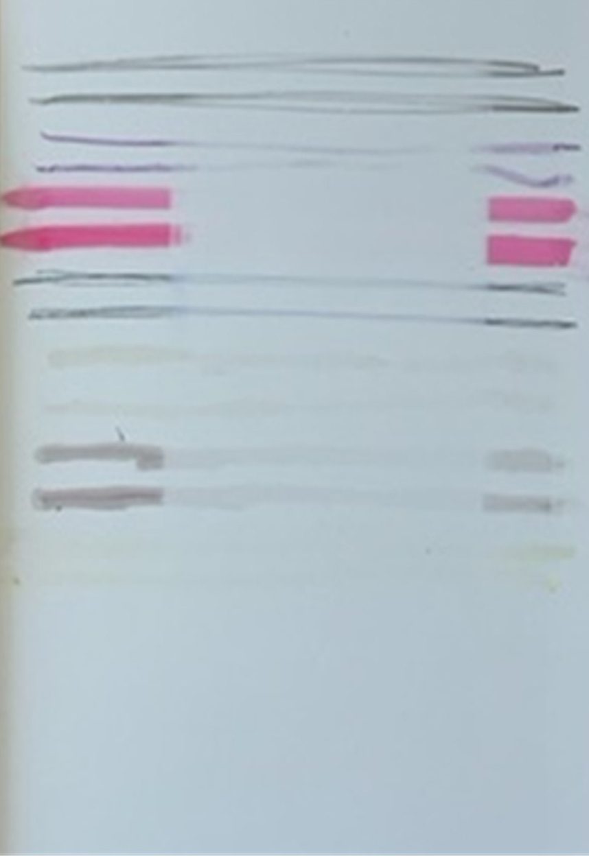 Horizontal lines and pink and grey marks on white.