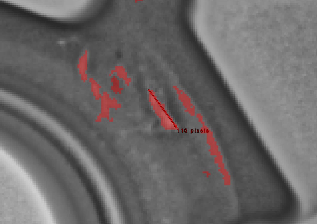 Shrinkage (Size filter: min 100, max 120 pixels) 