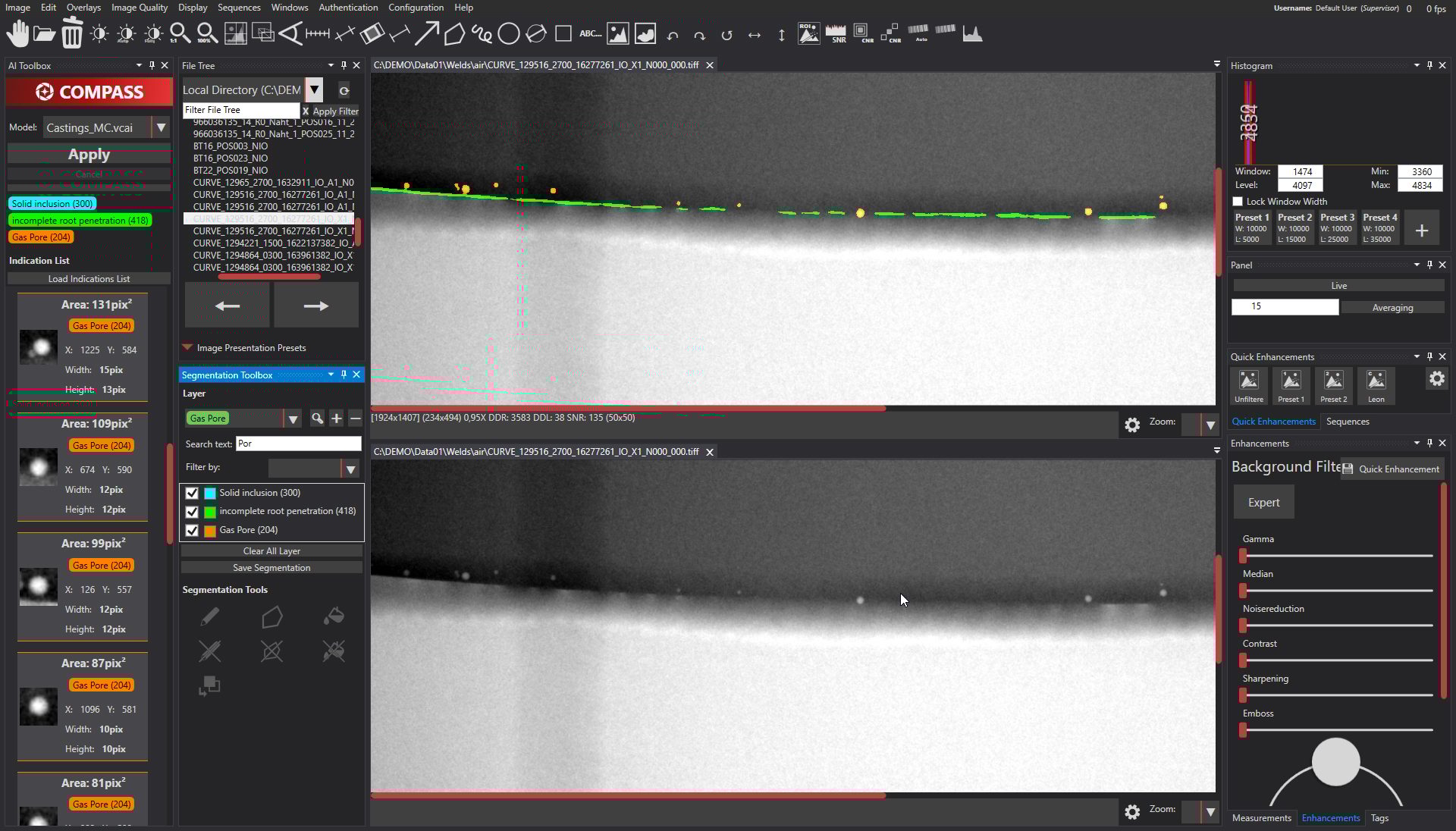 art X-ray image processing software