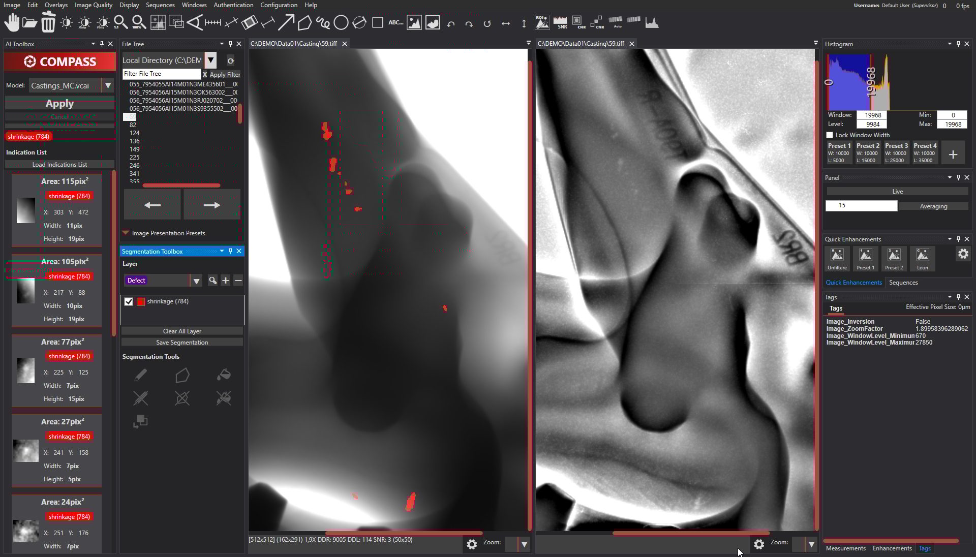 This comparison shows a casting with cavities, which the AI-supported module reliably detects – on the left in the image. These are otherwise only visible with the help of special image filters – as can be seen on the right – and are difficult to detect.