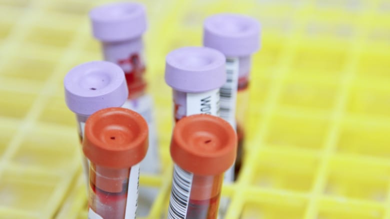 Laboratory equipment, Test tube