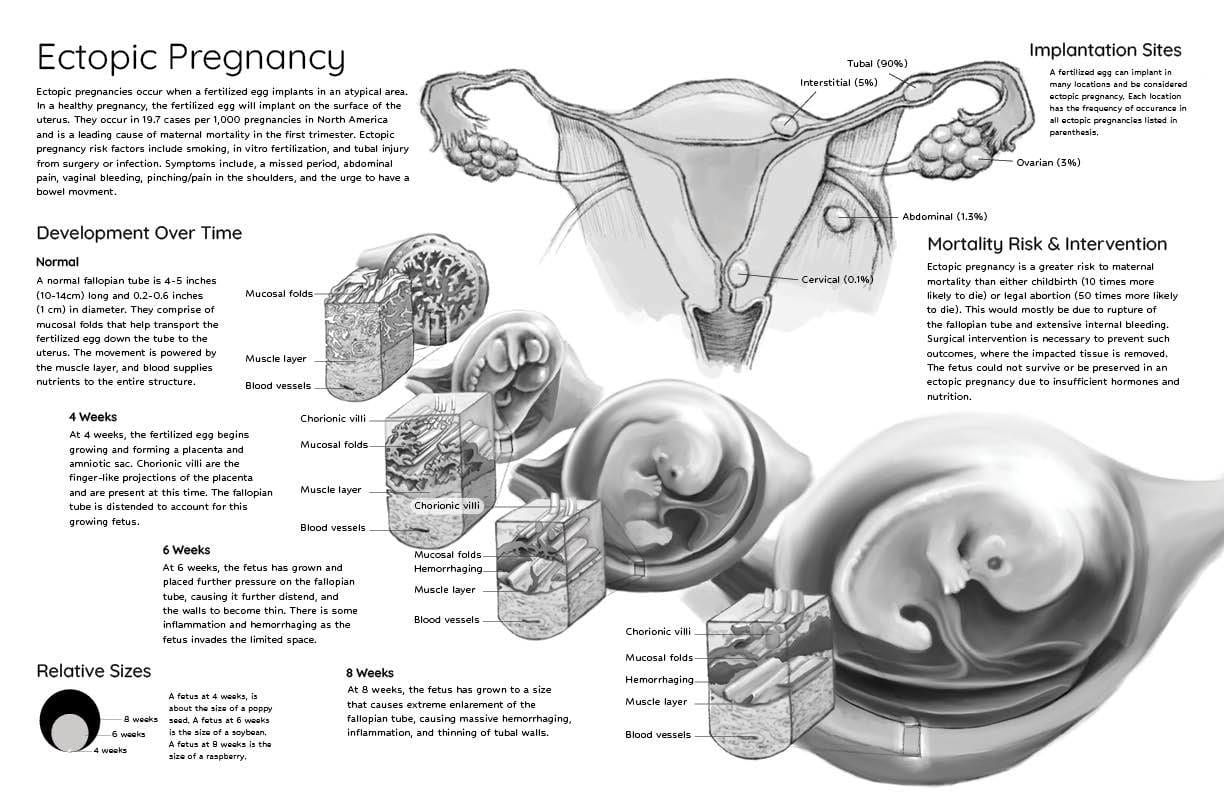 Organism, Font