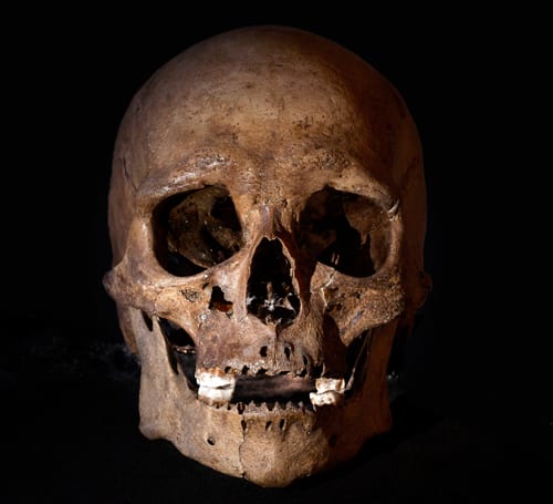 Brown human skull with visible teeth against a dark background, dramatically lit.
