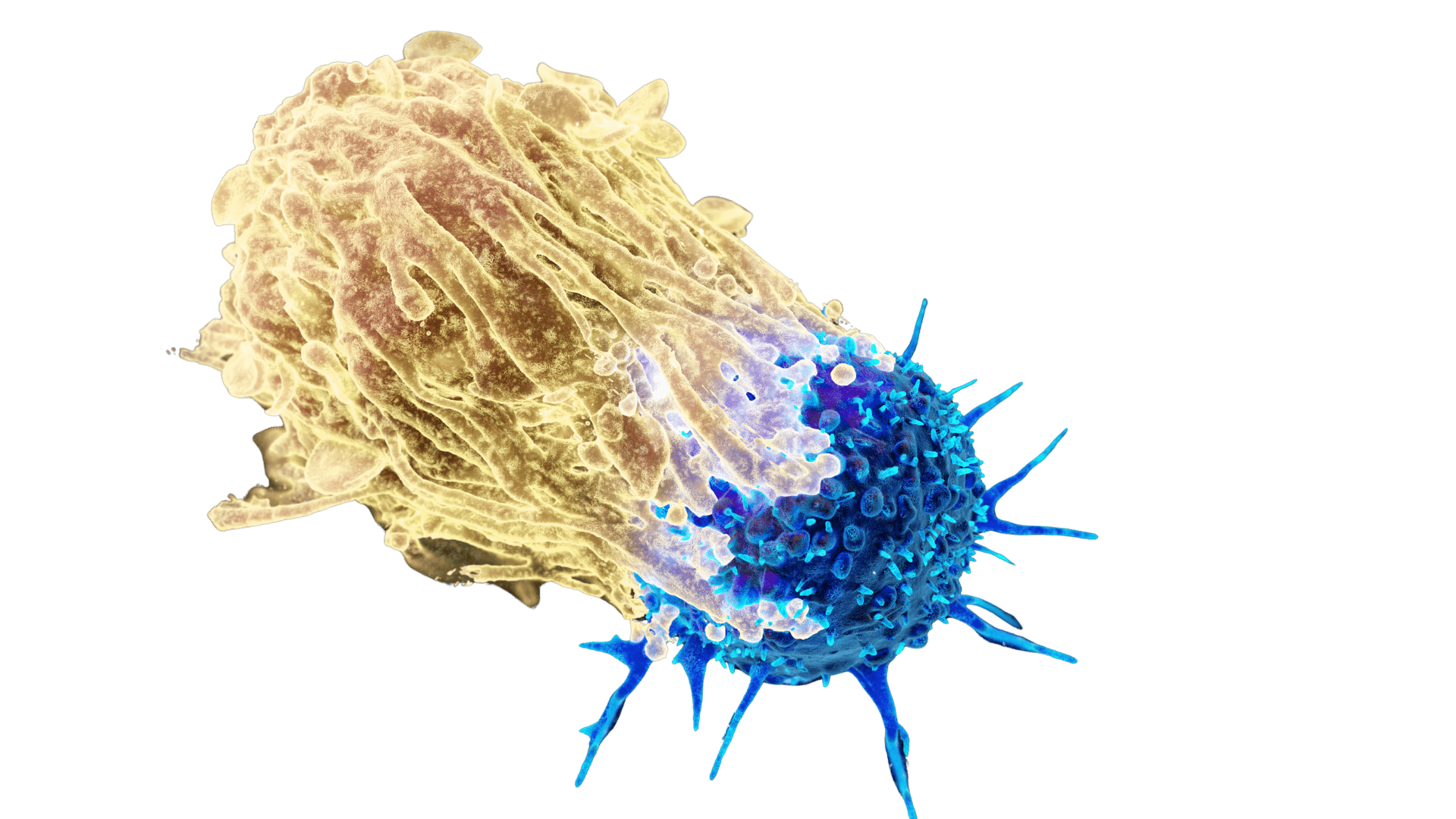 Scanning electron micrograph of an immune cell (yellow) interacting with another cell (blue, spiky).