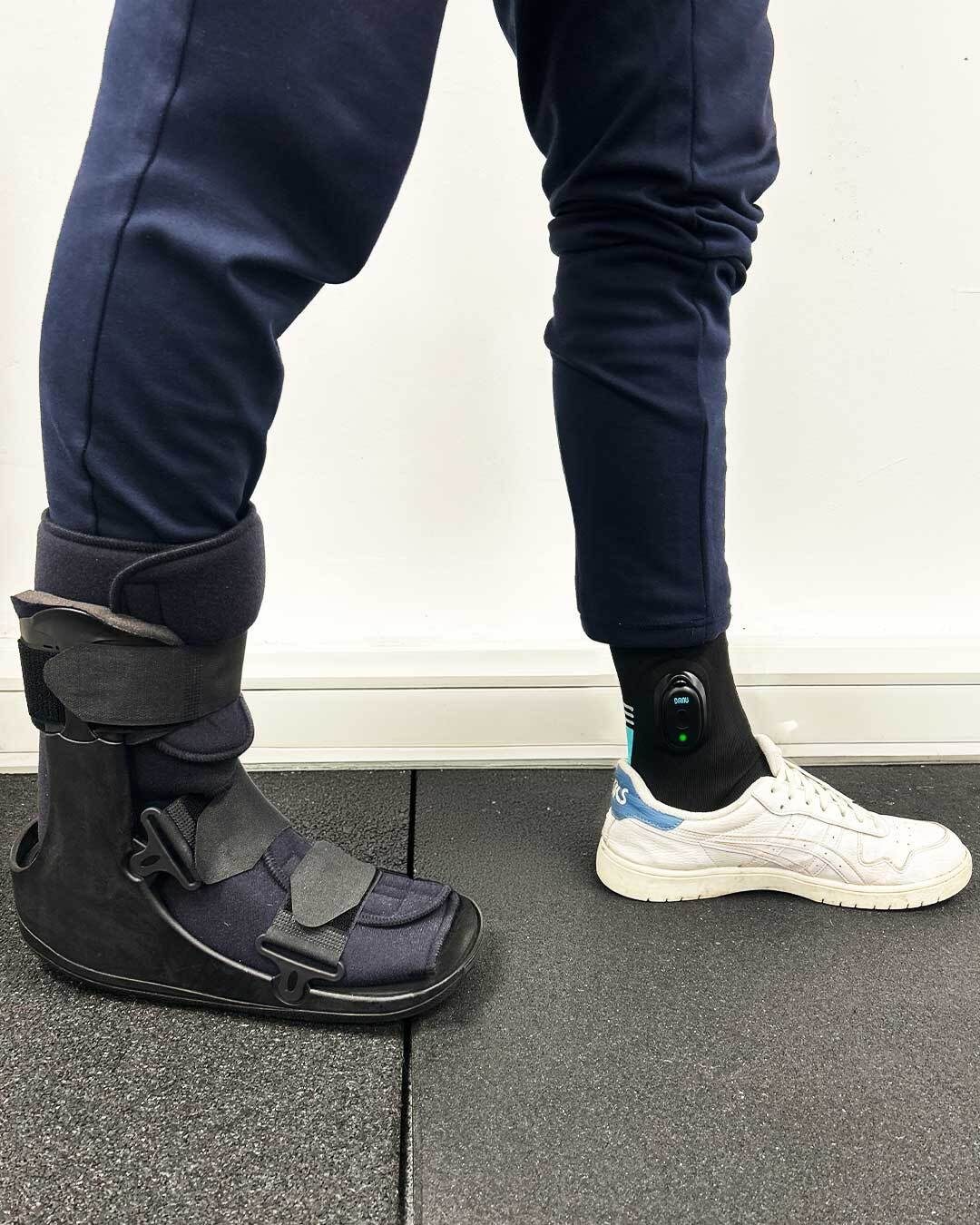 A person's legs, one in a black medical walking boot, the other in a white sneaker with an ankle-worn sensor.