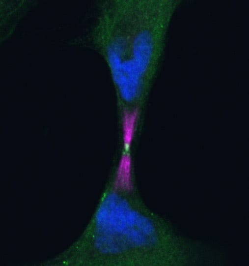 Den lysande, grøne prikken midt mellom to celler som straks er delte, er proteinet Katharina Vestre forskar på. Å finne det akkurat her, var heilt uventa for henne. Foto: Katharina Vestre