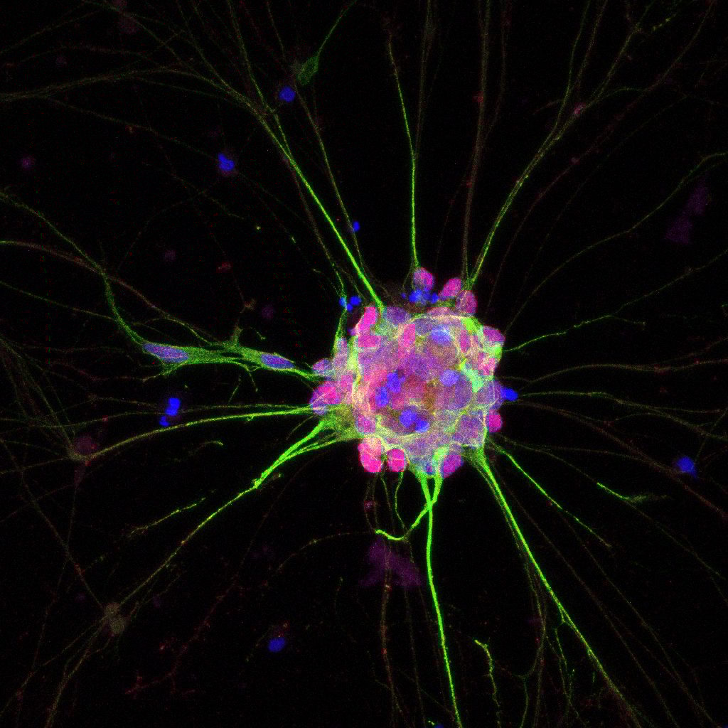A fluorescent microscopy image of a neural cell cluster with green neurites radiating from a magenta and blue core.