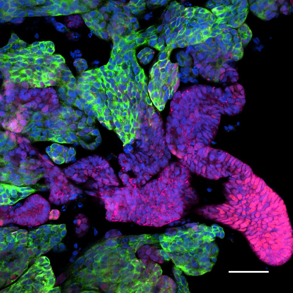 Fluorescent image of cell clusters with green, purple, and blue stains, highlighting cellular structures.
